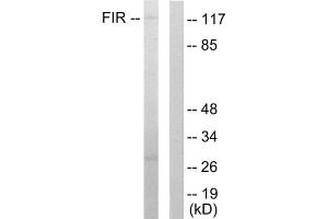 Western blot analysis of extracts from HuvEc cells, using FIR antibody. (FARP2 anticorps  (Internal Region))