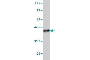 Western Blot detection against Immunogen (36. (LIM Domain Kinase 1 anticorps  (AA 548-647))