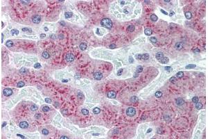 Human Liver: Formalin-Fixed, Paraffin-Embedded (FFPE) (RBP4 anticorps  (AA 19-202))