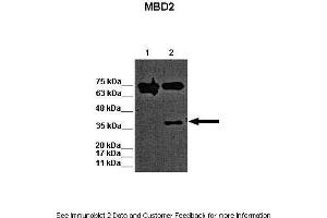 Lanes:   Lane 1: 15ug WT mouse ES lysate Lane 2: 15ug MBD2 KO mouse ES lysate  Primary Antibody Dilution:   1:1000  Secondary Antibody:   Goat anti-rabbit-HRP  Secondary Antibody Dilution:   1:2500  Gene Name:   MBD2 a  Submitted by:   Austin J. (MBD2 anticorps  (N-Term))