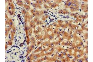 Immunohistochemistry of paraffin-embedded human liver tissue using ABIN7145493 at dilution of 1:100