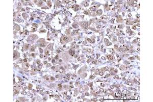 IHC analysis of RNGTT using anti-RNGTT antibody (ABIN7599723).