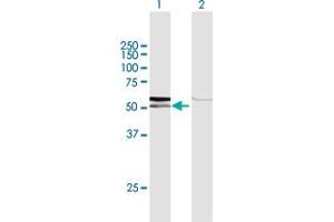 Western Blot analysis of AMY1C expression in transfected 293T cell line by AMY1C MaxPab polyclonal antibody.