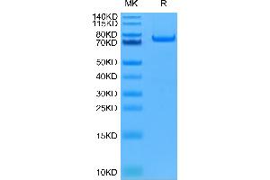 Human PADI4 on Tris-Bis PAGE under reduced condition. (PAD4 Protein (AA 1-663) (His tag))
