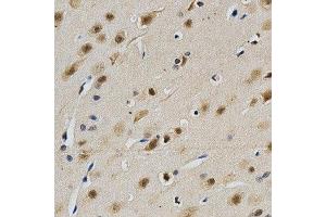 Immunohistochemistry of paraffin-embedded rat brain using LGALS3 antibody at dilution of 1:200 (x40 lens) (Galectin 3 anticorps)