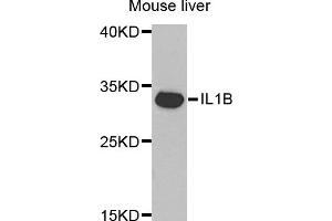 Western blot analysis of extracts of mouse liver, using IL1B antibody (ABIN5970463) at 1/1000 dilution. (IL-1 beta anticorps)