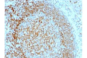 Formalin-fixed, paraffin-embedded human Tonsil stained with CD74 Mouse Monoclonal Antibody (LN-2).