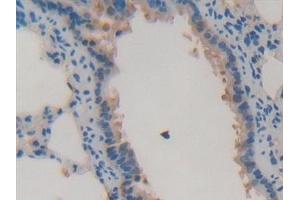 Detection of GSTA4 in Rat Lung Tissue using Polyclonal Antibody to Glutathione S Transferase A4 (GSTA4)
