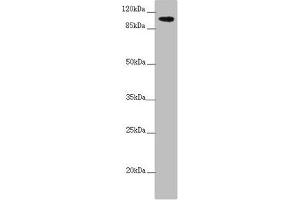 Western blot All lanes: TTLL7 antibody at 2.