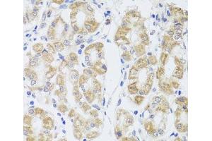 Immunohistochemistry of paraffin-embedded Human stomach using MIP Polyclonal Antibody at dilution of 1:100 (40x lens). (Mip anticorps)