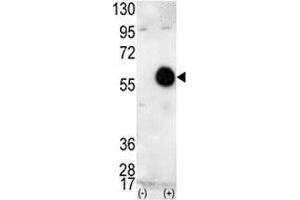 Western blot analysis of AKT2 antibody and 293 cell lysate (2 ug/lane) either nontransfected (Lane 1) or transiently transfected with the human gene (2). (AKT2 anticorps  (AA 416-444))