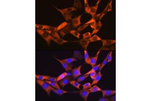 Immunofluorescence analysis of NIH-3T3 cells using F Rabbit mAb (ABIN7267150) at dilution of 1:100 (40x lens).