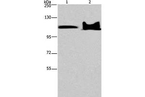 Western Blot analysis of Mouse heart and brain tissue using KDM4C Polyclonal Antibody at dilution of 1:800 (KDM4C anticorps)