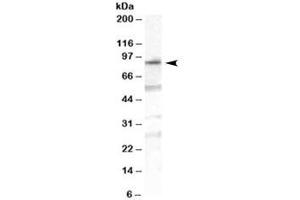 Western blot testing of human duodenum lysate with OSBPL10 antibody at 1ug/ml.