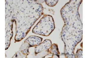 Immunoperoxidase of monoclonal antibody to CLIC5 on formalin-fixed paraffin-embedded human placenta.