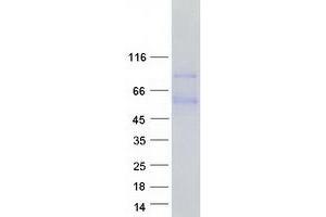 Validation with Western Blot