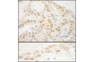 Immunohistochemistry (IHC) image for anti-MKL/myocardin-Like 2 (MKL2) (AA 1038-1088) antibody (ABIN7454863)