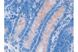 Detection of SPA2 in Rat Small intestine Tissue using Polyclonal Antibody to Surfactant Associated Protein A2 (SPA2)