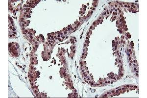 Immunohistochemical staining of paraffin-embedded Human breast tissue using anti-SAMHD1 mouse monoclonal antibody. (SAMHD1 anticorps)