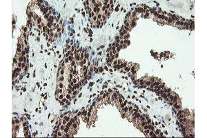 Image no. 9 for anti-SAM Domain and HD Domain 1 (SAMHD1) antibody (ABIN1500798)