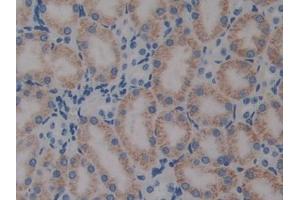 DAB staining on IHC-P; Samples: Mouse Kidney Tissue (PTX3 anticorps  (AA 183-381))