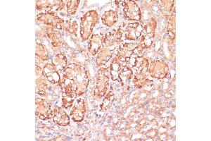 Immunohistochemistry of paraffin-embedded mouse kidney using MEK3 antibody (ABIN6130544, ABIN6143484, ABIN6143485 and ABIN6223650) at dilution of 1:100 (40x lens).