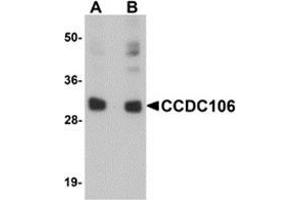 Western blot analysis of CCDC106 in human brain tissue lysate with CCDC106 antibody at (A) 0. (CCDC106 anticorps  (C-Term))