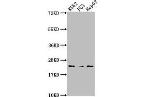 Western Blot Positive WB detected in: K562 whole cell lysate, PC3 whole cell lysate, HepG2 whole cell lysate All lanes: BLVRB antibody at 1:2000 Secondary Goat polyclonal to rabbit IgG at 1/50000 dilution Predicted band size: 23 kDa Observed band size: 23 kDa (BLVRB anticorps  (AA 2-206))