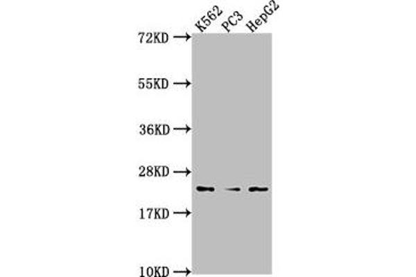 BLVRB anticorps  (AA 2-206)