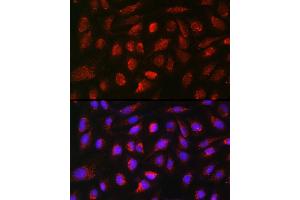 Immunofluorescence analysis of U2OS cells using BMP7 antibody (ABIN3021108, ABIN3021109, ABIN3021110 and ABIN6213955) at dilution of 1:150.