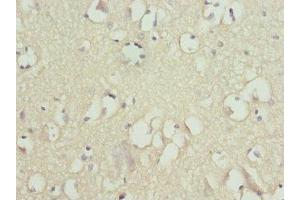 Immunohistochemistry of paraffin-embedded human brain tissue using ABIN7170056 at dilution of 1:100