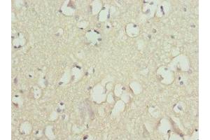 Immunohistochemistry of paraffin-embedded human brain tissue using ABIN7170056 at dilution of 1:100 (FXYD2 anticorps  (AA 1-64))
