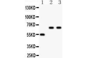Anti- CYP2E1 antibody, Western blotting All lanes: Anti CYP2E1  at 0.