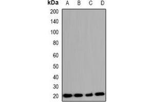 Western blot analysis of COX4-2 expression in A549 (A), K562 (B), mouse lung (C), rat lung (D) whole cell lysates. (COX4I2 anticorps)