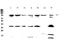 Western blot analysis of FES using anti-FES antibody . (FES anticorps)