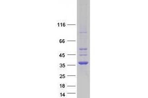 Validation with Western Blot (CDYL Protein (Transcript Variant 3) (Myc-DYKDDDDK Tag))