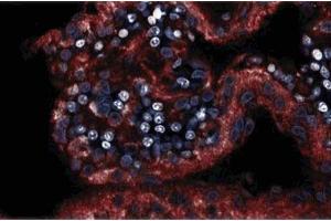 Immunofluorescence staining on a rabbit brain section.