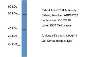 Western Blotting (WB) image for anti-RRS1 Ribosome Biogenesis Regulator (RRS1) (C-Term) antibody (ABIN786488) (RRS1 anticorps  (C-Term))