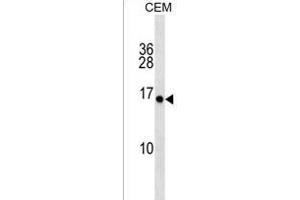 PLGLA Antibody (N-term) (ABIN1539205 and ABIN2850410) western blot analysis in CEM cell line lysates (35 μg/lane). (PLGLA anticorps  (N-Term))