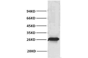 Western blot analysis of Hela, diluted at 1:1000.