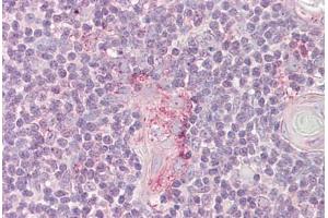 Anti-LYN antibody IHC staining of human thymus. (LYN anticorps  (AA 39-58))