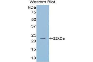 Western Blotting (WB) image for anti-Angiopoietin 1 (ANGPT1) (AA 253-429) antibody (ABIN1171922) (Angiopoietin 1 anticorps  (AA 253-429))