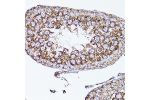 Immunohistochemistry of paraffin-embedded mouse testis using VD Rabbit pAb (ABIN7271337) at dilution of 1:150 (40x lens).