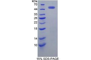 SDS-PAGE of Protein Standard from the Kit  (Highly purified E. (ErbB2/Her2 Kit ELISA)