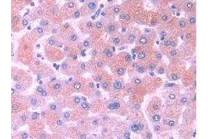 Detection of MOSC1 in Human Liver Tissue using Polyclonal Antibody to MOCO Sulphurase C-Terminal Domain Containing Protein 1 (MOSC1) (MOSC1 anticorps  (AA 41-335))