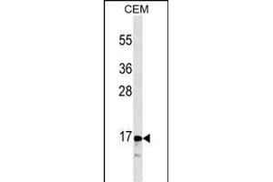 CALCA/CT Antibody (ABIN1536609 and ABIN2843838) western blot analysis in CEM cell line lysates (35 μg/lane). (Calcitonin anticorps  (AA 56-84))