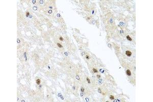 Immunohistochemistry of paraffin-embedded Rat brain using YTHDF3 Polyclonal Antibody at dilution of 1:100 (40x lens).