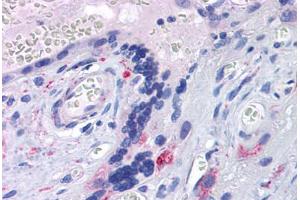 Human Placenta: Formalin-Fixed, Paraffin-Embedded (FFPE)