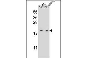 LSM7 Antibody (C-term) (ABIN655625 and ABIN2845104) western blot analysis in CEM cell line and mouse spleen tissue lysates (35 μg/lane). (LSM7 anticorps  (C-Term))
