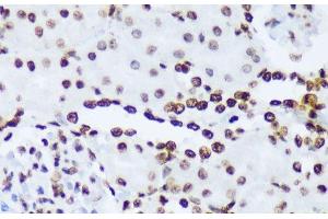 Immunohistochemistry of paraffin-embedded Rat kidney using Phospho-ABL1(Y245) Polyclonal Antibody at dilution of 1:100 (40x lens). (ABL1 anticorps  (pTyr245))